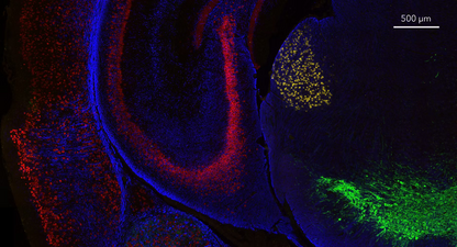 HCR™ Gold RNA-FISH Kit