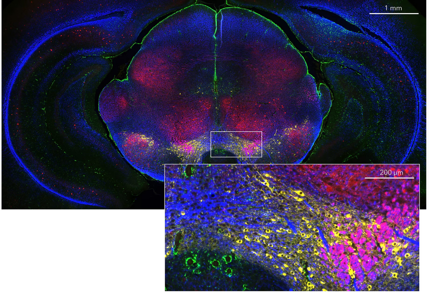 HCR™ Gold RNA-FISH Kit
